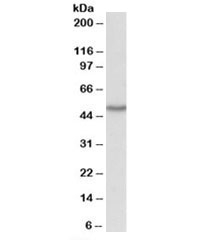Western blot testing of HepG2 lysate with OAS1 antibody at 1ug/ml. Predicted molecular weight: ~46kDa.