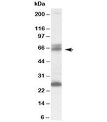 Western blot testing of human brain lysate with GAD65 antibody at 0.1ug/ml. The expected ~65kDa band and the additional ~26kDa band are both blocked by the immunizing peptide.