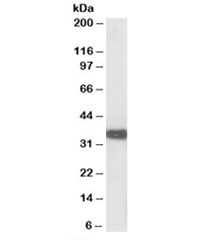 Western blot testing of mouse kidney lysate with Aspa antibody at 0.01ug/ml. Predicted molecular weight: ~35kDa.