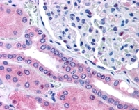 IHC testing of FFPE human kidney with Rhophilin 2 antibody at 5ug/ml. HIER: steamed with pH6 citrate buffer, AP-staining.