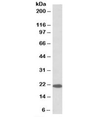 Western blot testing of human cerebellum lysate with Dnajc5 antibody at 0.1ug/ml. Predicted molecular weight: 22 kDa.