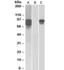 Western blot of HEK293 lysate overexpressing human PCSK9 with MYC tag probed with PCSK9 antibody [1ug/ml] in Lane A and probed with anti-MYC tag [1/1000] in lane C. Mock-transfected HEK293 probed with PCSK9 antibody [1ug/ml] in Lane B.