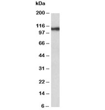 Western blot testing of human thyroid gland lysate with Thyroid Peroxidase antibody at 0.3ug/ml. Predicted molecular weight ~103 kDa but may be observed at higher molecular weights due to glycosylation.