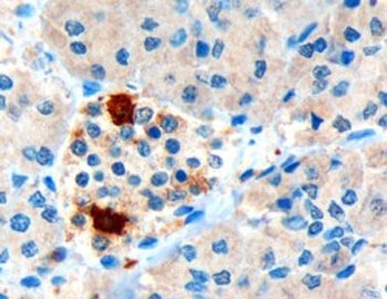 IHC testing of FFPE human pancreas with Pancreatic Polypeptide antibody at 3ug/ml. HIER: microwaved with pH9 Tris/EDTA buffer, HRP-staining. Strong cytoplasmic staining of cells at the periphery of the pancreatic islets is seen.
