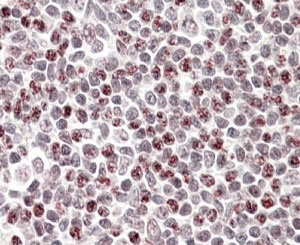 IHC testing of FFPE human tonsil with APOBEC3A antibody at 4ug/ml. HIER: steamed with pH6 citrate buffer, AP-staining.