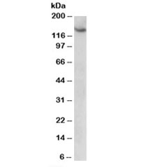 Western blot testing of HeLa lysate with AGTPBP1 antibody at 1ug/ml. Predicted molecular weight: ~138kDa.