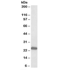 Western blot of rat kidney lysate with GM2A antibody at 0.3ug/ml. Predicted molecular weight ~22kDa.