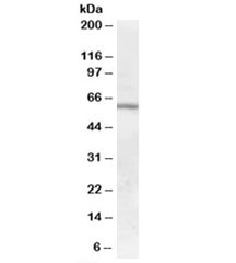 Western blot testing of human bone marrow lysate with GALNS antibody at 0.01ug/ml. Predicted molecular weight: ~58 kDa.