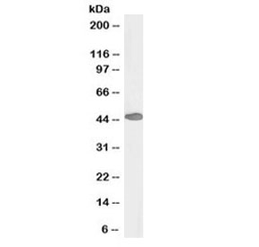 Western blot testing of human duodenum lysate with biotinylated PAX3 antibody at 0.5ug/ml. Predicted molecular weight: can detect 7 isoforms ranging from 22~56kDa.