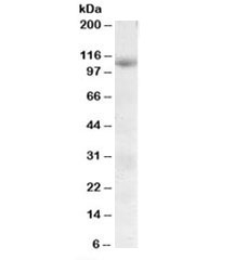 Western blot testing of human skeletal muscle lysate with SNX19 antibody at 0.3ug/ml. Predicted/observed molecular weight: ~110kDa.