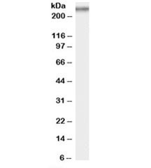 Western blot testing of rat testis lysate with COL7A1 antibody at 0.5ug/ml. Expected molecular weight: 259-300 kDa.