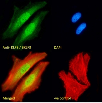 Western blot testing of human kidney lysate with KLF8 antibody at 2ug/ml. Predicted molecular weight: ~39 kDa but can be observed at up to 60 kDa.