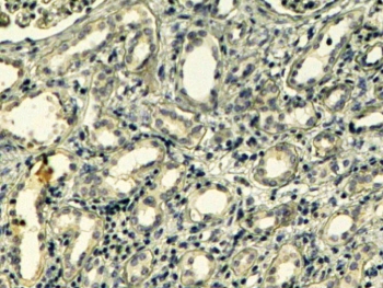 IHC testing of FFPE human kidney with Tensin antibody at 4ug/ml. HIER: steamed with pH9 Tris/EDTA buffer, HRP-staining. Weak staining of the basement membranes of the convoluted tubules is seen.
