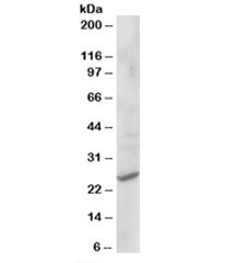Western blot testing of human liver lysate with CYB561D2 antibody at 1ug/ml. Predicted/observed molecular weight: ~25kDa.