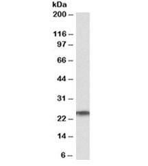 Western blot testing of human testis lysate with RAN antibody at 1ug/ml. Predicted molecular weight ~25kDa.