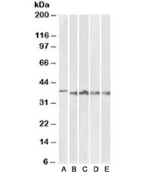 Western blot testing of thymus [A], lymph node [B], tonsil [C], spleen [D] and testis [E] lysates with Aurora B antibody at 1ug/ml. Predicted molecular weight: 39-45 kDa