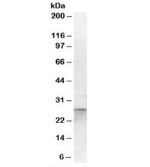 Western blot testing of human cerebellum lysate with OTUB2 antibody at 1ug/ml. Predicted/observed molecular weight: ~27kDa.