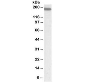 Western blot testing of human spleen lysate with LFA-1 antibody at 0.5ug/ml. Predicted molecular weight: ~129 kDa (unmodified), up to 200 kDa (glycosylated).