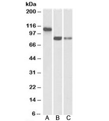 Western blot testing of human A) heart, B) amygdala, C) hippocampus lysate with T-Cadherin antibody at 0.3ug/ml. Predicted molecular weight: ~83kDa and 105/130kDa (glycosylated mature form/partially processed precursor).