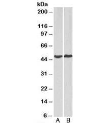 Western blot testing of human A) HeLa and B) MCF7 cell lysate with PRKACA antibody at 2ug/ml. Predicted molecular weight of isoforms: 38~47kDa.