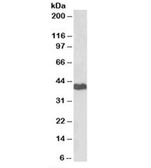 Western blot testing of human HeLa cell lysate with PRKACA antibody at 2ug/ml. Predicted molecular weight of isoforms: 38~47kDa.