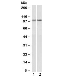 Western blot testing of 1) human heart and 2) mouse heart lysate with ITGA3 antibody at 1ug/ml. Expected molecular weight: 119-150 kDa depending on glycosylation level.