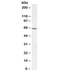 Western blot testing of human K562 lysate with PLK antibody at 1ug/ml. Predicted molecular weight ~68kDa.