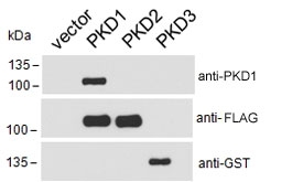 PKD1-FLAG, PKD2-FLAG and PKD3-GST transfected HEK293 cell lysate probed with GST, FLAG or PKD1 antibody at 0.1ug/ml. Expected molecular weight ~102 kDa. Data courtesy of Dr Peter Storz, Mayo Clinic, USA.