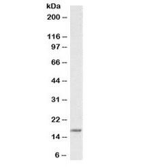 Western blot testing of human Daudi cell lysate with CD83 antibody at 1ug/ml. Predicted molecular weight: ~22/22/17 kDa (isoforms a/b/c). The glycosylated form of the protein is visualized at 40-60 kDa.