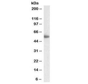 Western blot testing of human spleen lysate with LILRA4 antibody at 2ug/ml. Predicted molecular weight: 55 kDa.