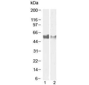 Western blot testing of human 1) lymph node and 2) tonsil tissue lysate with LAG3 antibody at 1ug/ml and 0.5ug/ml, respectively. Predicted molecular weight ~54 kDa.