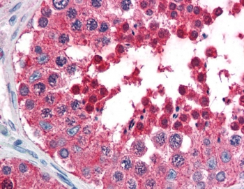 IHC testing of FFPE human testis tissue with HSPA4L antibody at 5ug/ml. HIER: steamed antigen retrieval with pH6 citrate buffer; AP-staining.