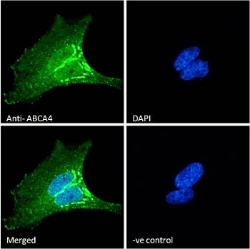 Abca4 Rp ABCA4 Antibody | ABCR | R36498 NSJ Bioreagents