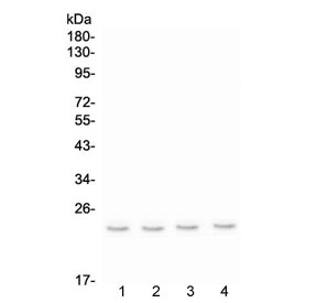 Western blot testing of 1) rat spleen, 2) rat thymus, 3) mouse spleen and 4) mouse thymus lysate with AICDA antibody at 0.5ug/ml. Predicted molecular weight ~24 kDa.
