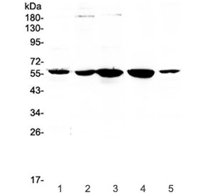 Western blot testing of human 1) placenta, 2) HeLa, 3) 22RV1, 4) SKOV and 5) A549 lysate with ETV6 antibody at 0.5ug/ml. Predicted molecular weight ~53 kDa.