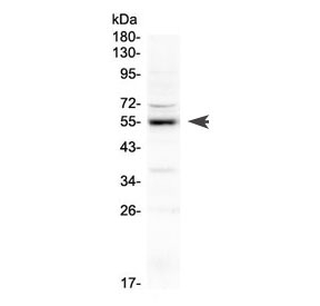 Western blot testing of rat lung lysate with EPOR antibody at 0.5ug/ml. Predicted molecular weight ~55 kDa (memebrane bound form), ~29 kDa (soluble form).