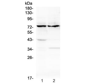 Western blot testing of rat 1) thymus and 2) stomach tissue lysate with ADAM10 antibody at 0.5ug/ml. Predicted molecular weight: ~84 kDa (full length), ~60 kDa (active form), ~80 kDa (glycosylated active form), ~110 kDa (glycosylated full length).