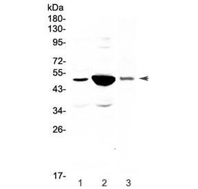 Western blot testing of 1) rat small intestine, 2) rat kidney and 3) mouse kidney lysate with Pai-1 antibody at 0.5ug/ml. Predicted molecular weight ~45 kDa.