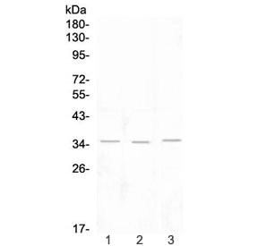 Western blot testing of 1) rat lymph, 2) rat spleen and 3) mouse thymus tissue lysate with NKG2D antibody at 0.5ug/ml. Predicted molecular weight ~25 kDa (unmodified), ~35 kDa (glycosylated).