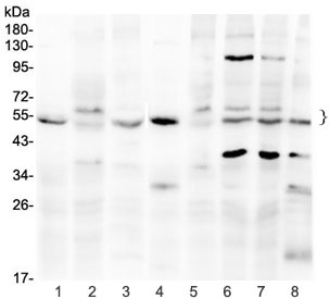 Western blot testing of 1) rat kidney, 2) rat testis, 3) mouse brain, 4) mouse kidney, 5) mouse testis, 6) human HeLa, 7) human A375 and 8) human HepG2 lysate with SMAD1/5 antibody at 0.5ug/ml. Expected molecular weight: 52-60 kDa.