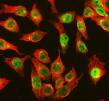 Immunofluorescent staining of FFPE human HeLa cells with OGG1 antibody (green) and Alpha Tubulin mAb (red). HIER: steam section in pH6 citrate buffer for 20 min.
