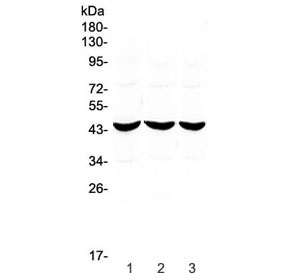 Western blot testing of 1) rat stomach, 2) rat kidney and 3) mouse small intestine lysate with ADA antibody at 0.5ug/ml. Predicted molecular weight ~41 kDa.