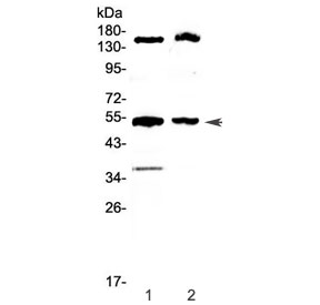 Western blot testing of 1) rat liver and 2) mouse liver lysate with Glucokinase antibody at 0.5ug/ml. Predicted molecular weight ~52 kDa.