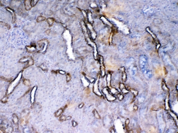 IHC testing of FFPE rat kidney tissue with Vegf receptor 2 antibody at 1ug/ml. Required HIER: steam section in pH6 citrate buffer for 20 min and allow to cool prior to testing.