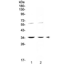 Western blot testing of human 1) HeLa and 2) SW620 cell lysate with IL12 p35 antibody at 0.5ug/ml. Predicted molecular weight ~25 kDa (unmodified), ~35 kDa (glycosylated).
