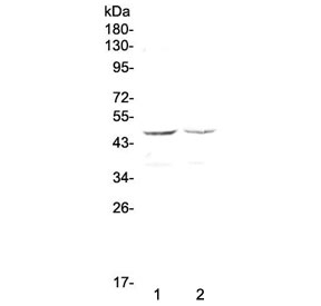 Western blot testing of human 1) HepG2 and 2) MCF7 cell lysate with GALT antibody at 0.5ug/ml. Predicted molecular weight ~43 kDa.