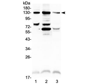 Western blot testing of mouse 1) ovary, 2) stomach and 3) kidney lysate with CD31 antibody at 0.5ug/ml. Expected molecular weight: 83-130 kDa depending on level of glycosylation.