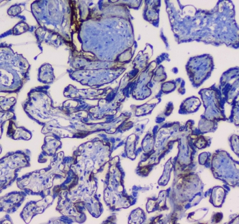 IHC testing of FFPE human placental tissue with ITGA5 antibody. Required HIER: steam section in pH6 citrate buffer for 20 min and allow to cool prior to testing.