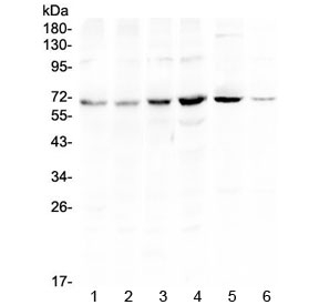 Western blot testing of human 1) HeLa, 2) U-87 MG, 3) COLO320, 4) HepG2, 5) rat brain and 6) mouse NIH3T3 lysate with PIAS3 antibody at 0.5ug/ml. Predicted molecular weight ~68 kDa.