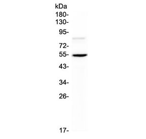 Western blot testing of mouse HEPA1-6 cell lysate with ANGPTL3 antibody at 0.5ug/ml. Expected molecular weight 50 ~ 63 kDa depending on glycosylation level.